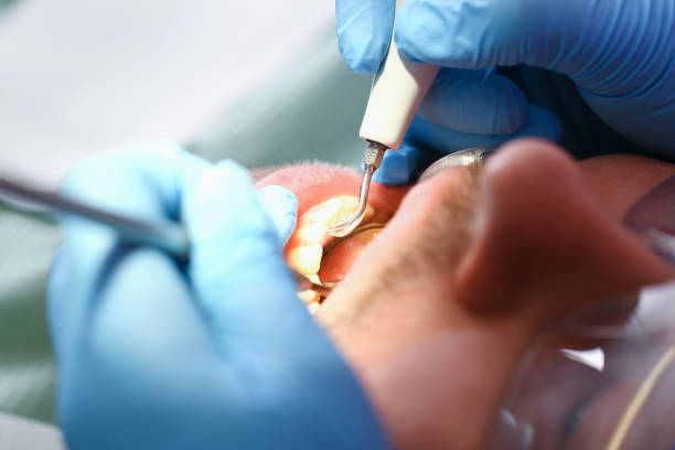 Best Same-Day Emergency Dentist in Panama, OK